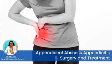 top Appendiceal Abscess surgeon in Delhi